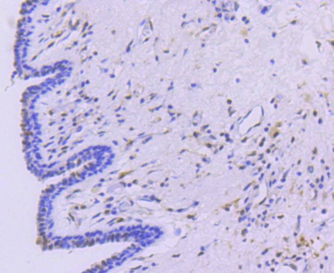 Anti-STAT5A Antibody (6E796)