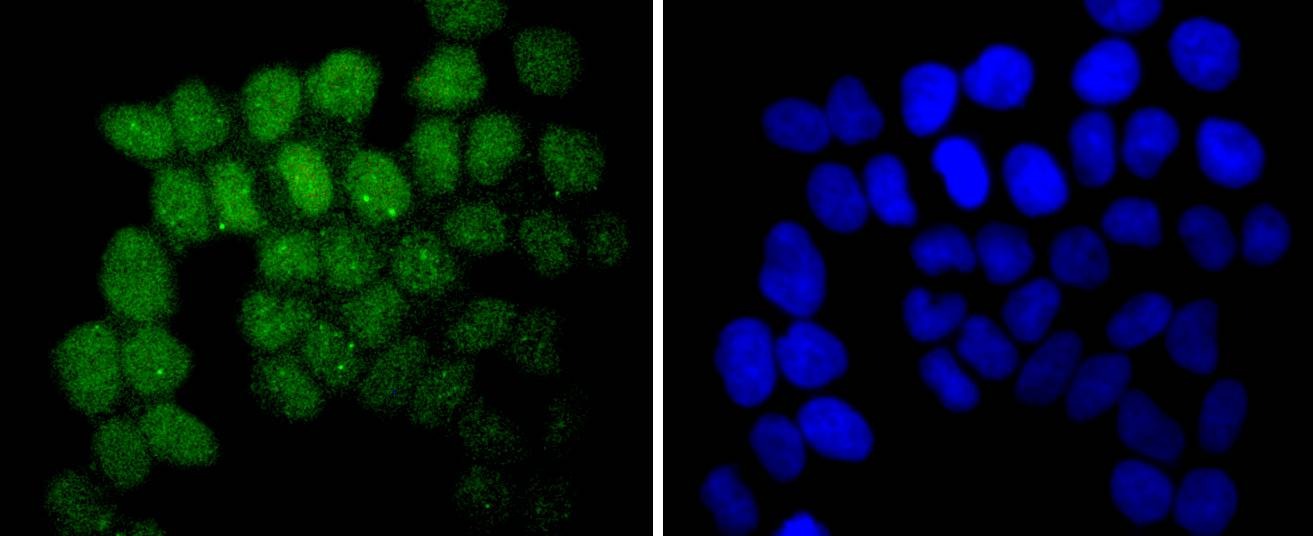 Anti-SUZ12 Antibody (5A460)
