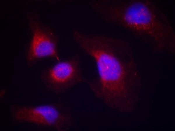 Anti-Phospho-Syk (Tyr323) Polyclonal Antibody
