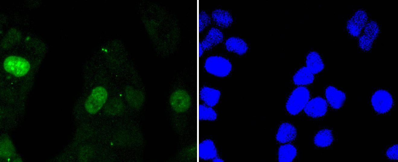 Anti-Survivin Antibody (3J595)