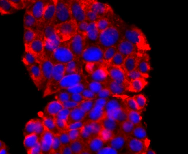 Anti-Synaptophysin/SYP Antibody (1U942)