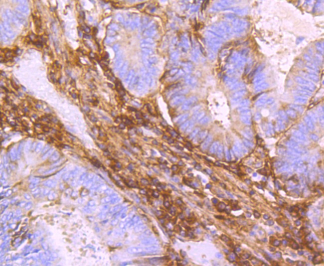 Anti-TGFBI Antibody (7P792)