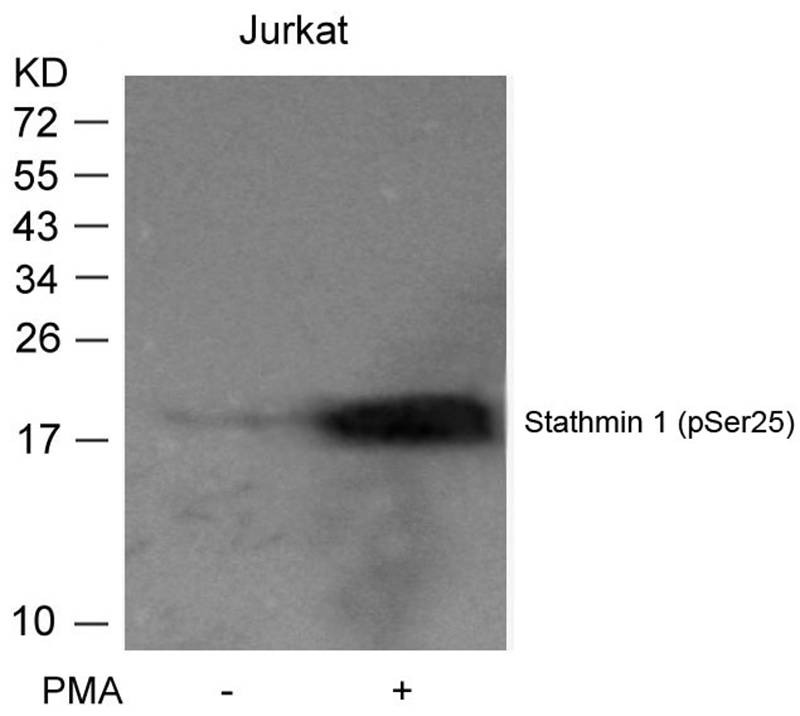 Anti-Phospho-Stathmin 1 (Ser25) Polyclonal Antibody