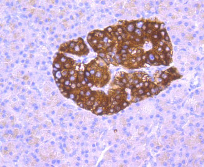 Anti-Synaptophysin/SYP Antibody (1U942)