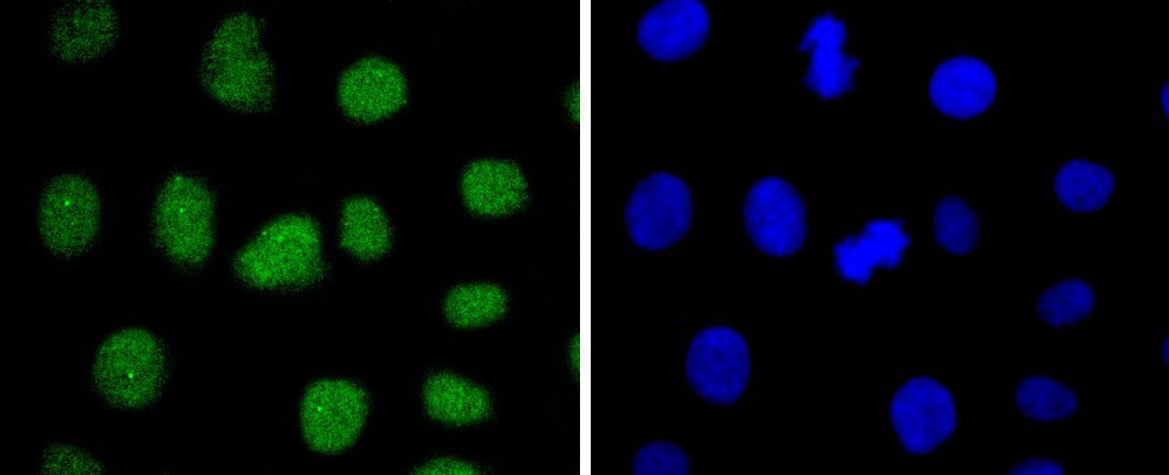 Anti-SUZ12 Antibody (5A460)