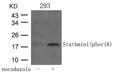 Anti-Phospho-Stathmin 1 (Ser16) Polyclonal Antibody