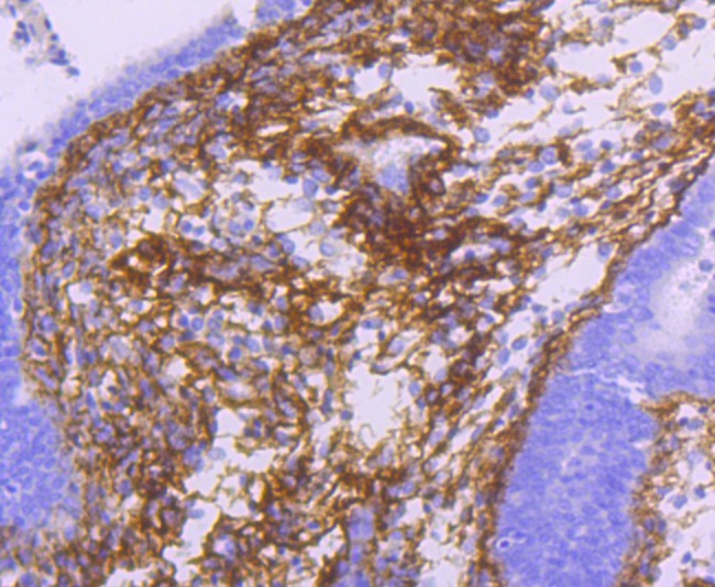Anti-TGFBI Antibody (7P792)