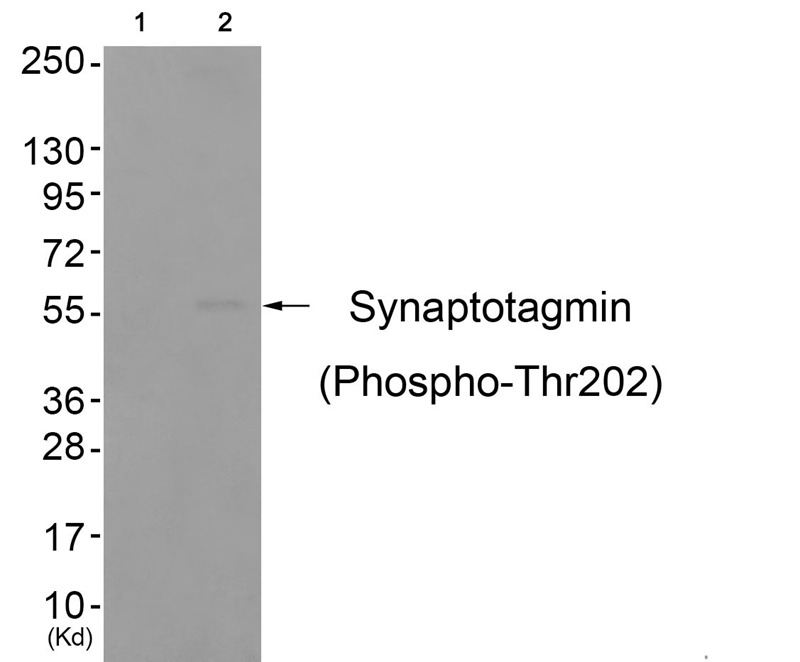 Anti-Phospho-Synaptotagmin-1 (Thr202) Polyclonal Antibody