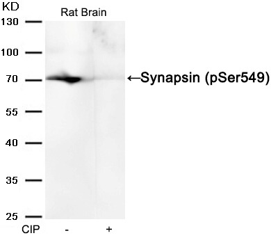 Anti-Phospho-Synapsin-1 (Ser549) Polyclonal Antibody