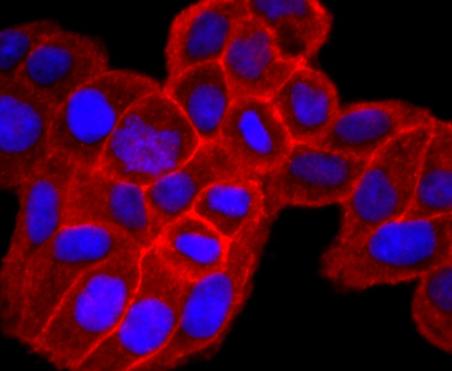 Anti-SDC1 Antibody (3T311)