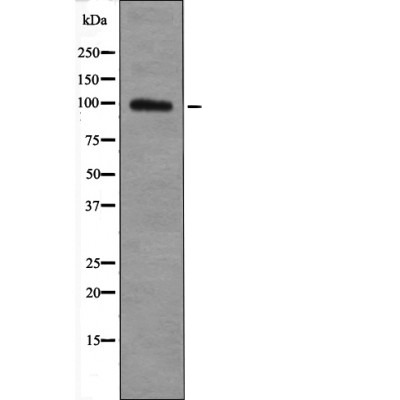 Anti-Phospho-TGF β Receptor III (Thr842) Polyclonal Antibody