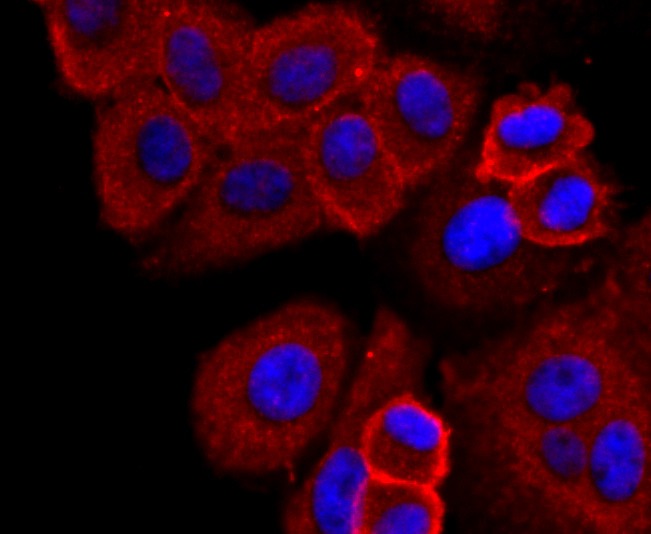 Anti-SDC1 Antibody (3T311)