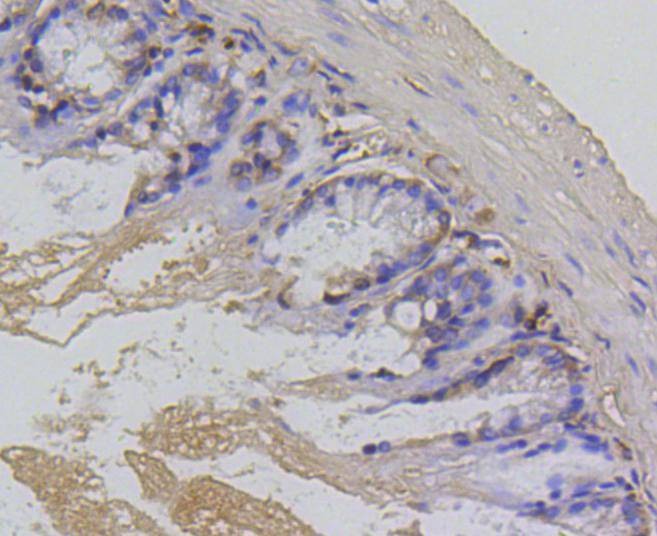 Anti-Survivin Antibody (2N702)