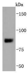Anti-SUZ12 Antibody (5A460)
