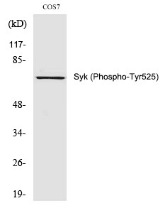 Anti-Phospho-Syk (Tyr525) Polyclonal Antibody