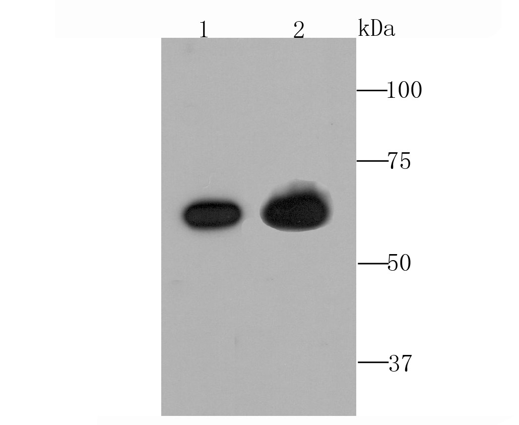 Anti-TGFBI Antibody (7P792)