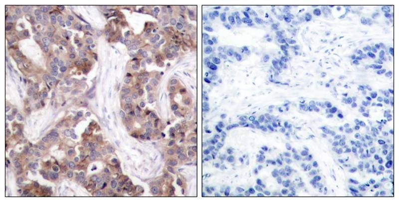 Anti-Phospho-Stathmin 1 (Ser25) Polyclonal Antibody