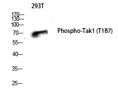 Anti-Phospho-TAK1 (Thr187) Polyclonal Antibody 2