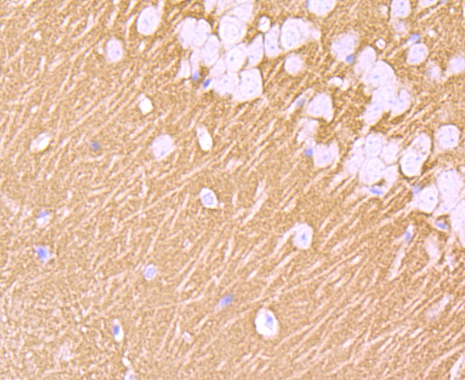 Anti-Synaptophysin/SYP Antibody (1U942)