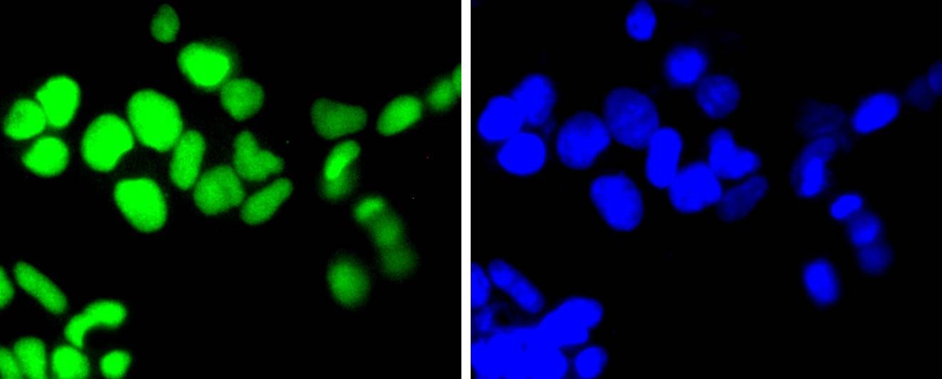 Anti-TOP1 Antibody (4H437)