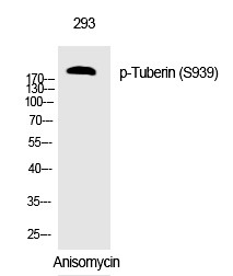 Anti-Phospho-Tuberin (Ser939) Polyclonal Antibody