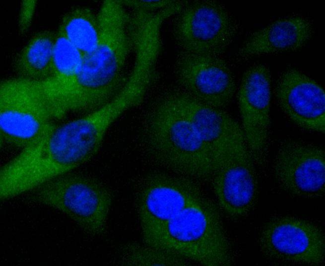 Anti-TRK fused gene Antibody (4L658)