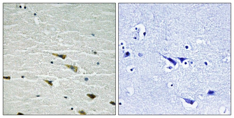Anti-Phospho-TrkA (Tyr757) Polyclonal Antibody