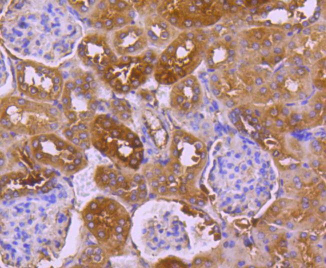Anti-TRK fused gene Antibody (4L658)