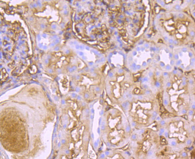 Anti-Transthyretin Antibody (5H602)