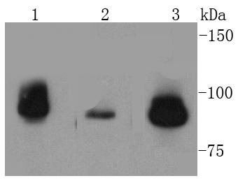 Anti-TOP1 Antibody (4H437)