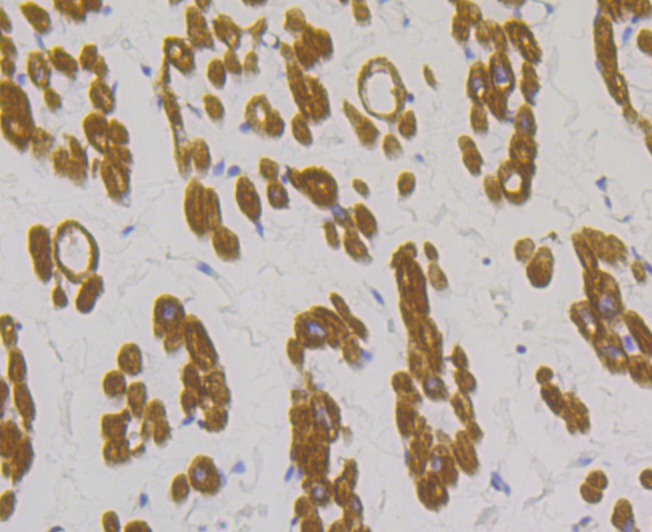 Anti-TPM1 Antibody (5W651)