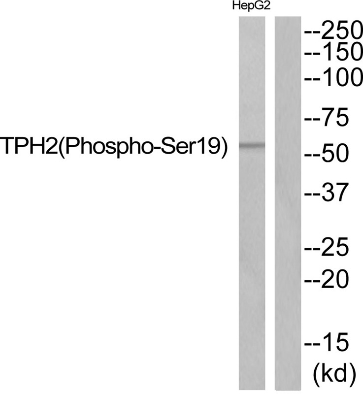 Anti-Phospho-TPH2 (Ser19) Polyclonal Antibody