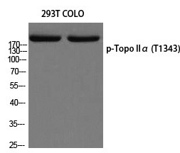Anti-Phospho-TOP2A (Thr1343) Polyclonal Antibody