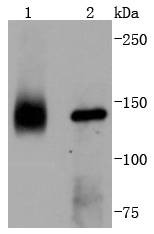 Anti-TrkA Antibody (8K93)