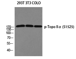 Anti-Phospho-TOP2A (Ser1525) Polyclonal Antibody