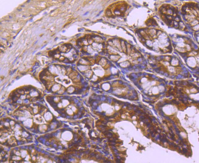Anti-TRK fused gene Antibody (4L658)