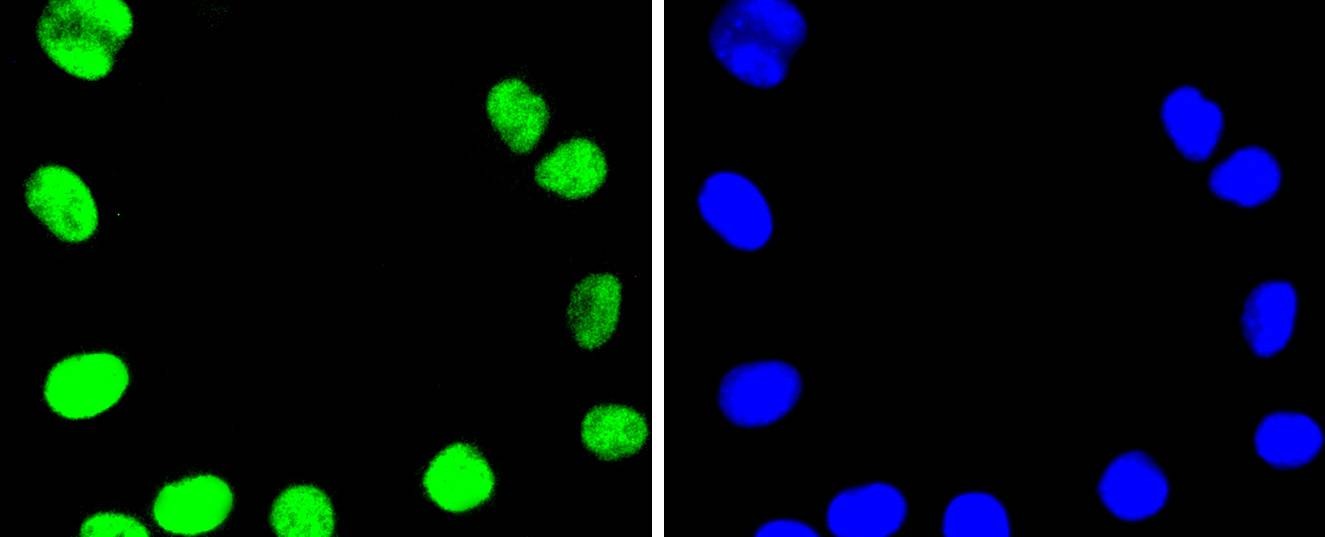 Anti-TOP1 Antibody (4H437)