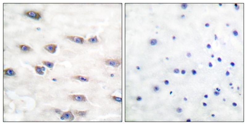 Anti-Phospho-TrkA (Tyr791) Polyclonal Antibody