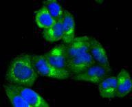 Anti-TRK fused gene Antibody (4L658)