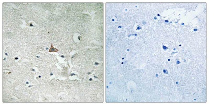 Anti-Phospho-NTRK2 (Tyr706, 707) Polyclonal Antibody