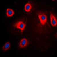 Anti-Phospho-MAP3K8 (Thr290) Polyclonal Antibody