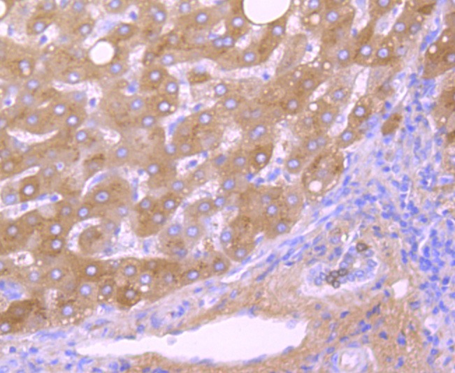 Anti-Transthyretin Antibody (5H602)