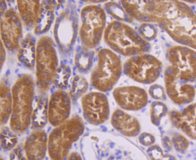 Anti-TOP2A Antibody (4D479)