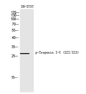 Anti-Phospho-TNNI3 (Ser22, 23) Polyclonal Antibody