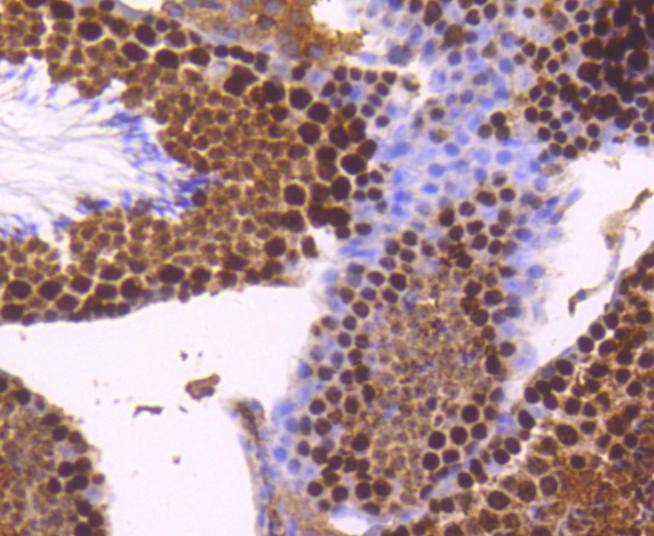 Anti-TOP2A Antibody (4D479)