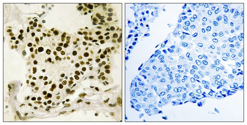 Anti-Phospho-Nucleolar transcription factor 1 (Ser484) Polyclonal Antibody
