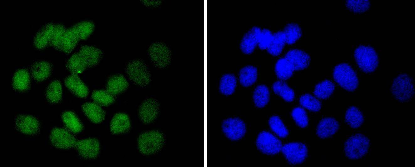 Anti-UBC9/UBE2I Antibody (6S11)