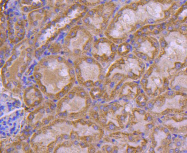 Anti-Ubiquitin D Antibody (7G418)