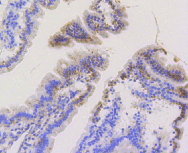 Anti-TOMM20 Antibody (6C702)