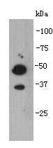Anti-TMEM177 Antibody (4I511)